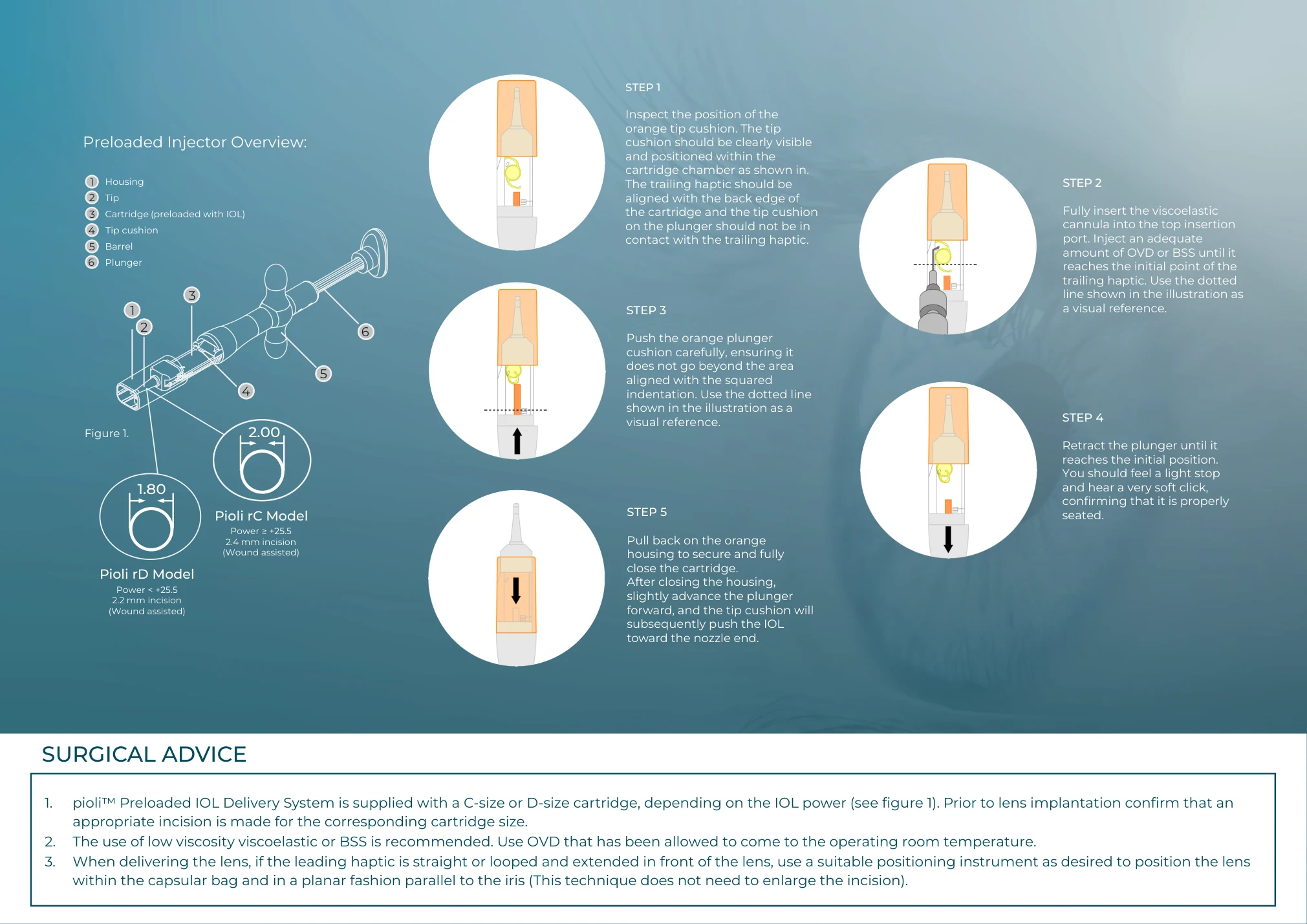 pioli quick user guide, step-by-step and surgical advice